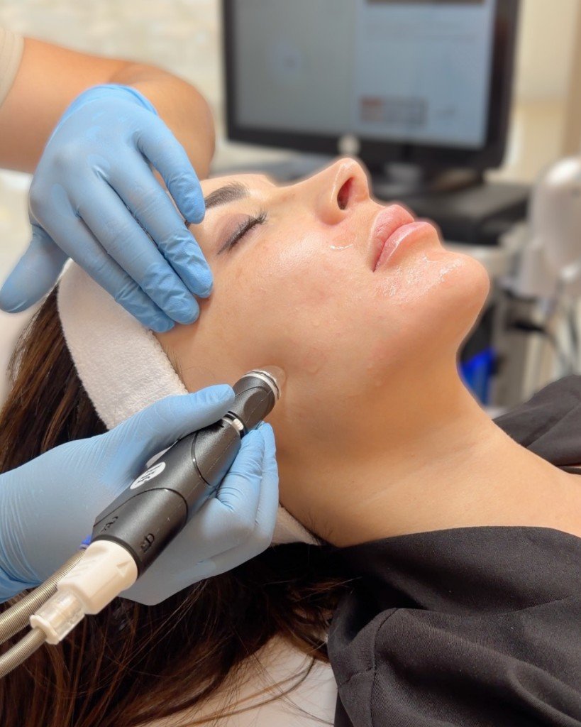 HydraFacial tratamiento facial